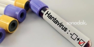 hantavirus-salgina-donusur-mu-kapali-alan-pakliginda-buyuk-risk-hAsmFeEJ.jpg